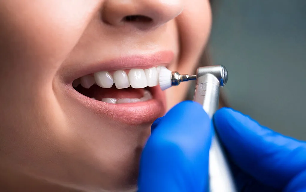 Limpieza dental profesional con instrumentos clínicos en Oraltek